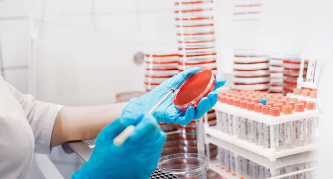Sampling with bacteriological loop of material colonies microorganisms grown on dense nutrient medium for research.